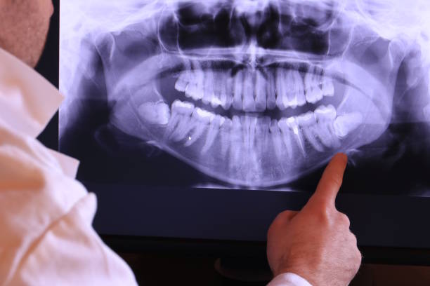 Best Emergency Treatment for Dental Infections or Abscesses in Sa De Oro Mount Helix, CA